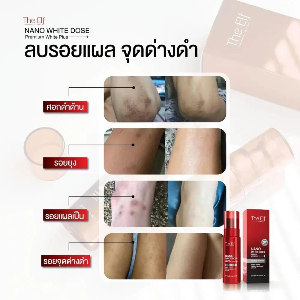 The Elf Nano White Dose Éclaircissante – 60 ml My Store
