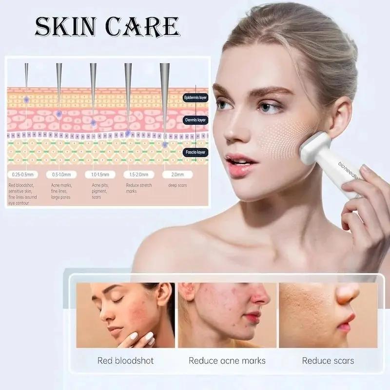 Bio Needle Derma Stamp – Micro Needling pour la Croissance des Cheveux My Store