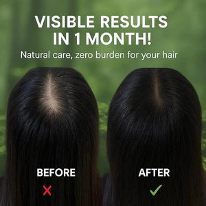 Nature Seven Green Shampoo Bar – Shampoing Solide Naturel Ecologique pour des Cheveux Sains et Eclatants My Store