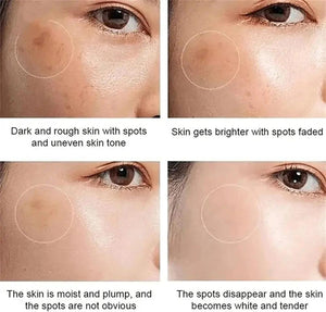 Dr Hancy White Spot Japan Cream – 20 g My Store