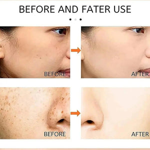 Dr Hancy White Spot Japan Cream – 20 g My Store