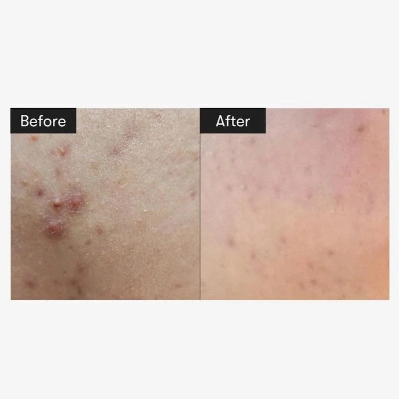 VT Serum Reedle Shot 100 50 ML