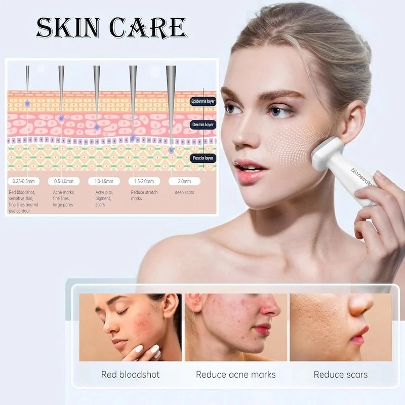 Bio Needle Derma Stamp – Micro Needling pour la Croissance des Cheveux